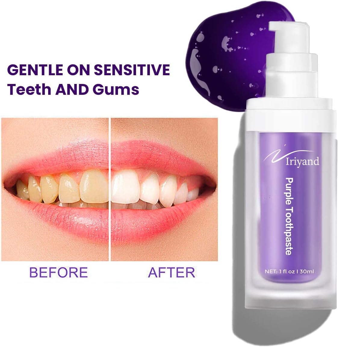 Purple Toothpaste , Purple Toothpaste, Purple Tooth Stain Removal, Teeth Whitening Booster, Teeth Whitener